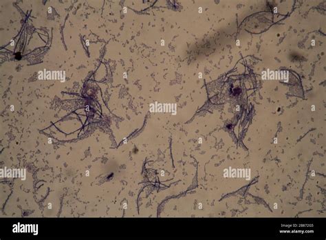 Rod-shaped bacteria under the microscope 400x Stock Photo - Alamy