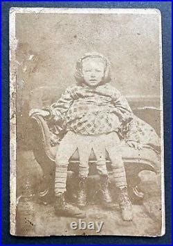 Myrtle Corbin the Four Legged Girl- RARE CDV as a Child Circus Sideshow ...