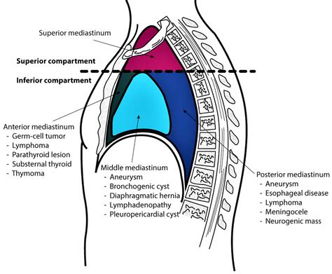 Mediastinum anatomy, location, cavity, organs, function & tumors