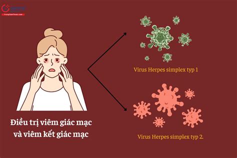 Trifluridine - Thuốc nhỏ mắt kháng virus - Dược thư Quốc gia 2022