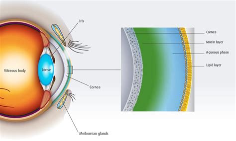 The dry eye syndrome - EvoTears®