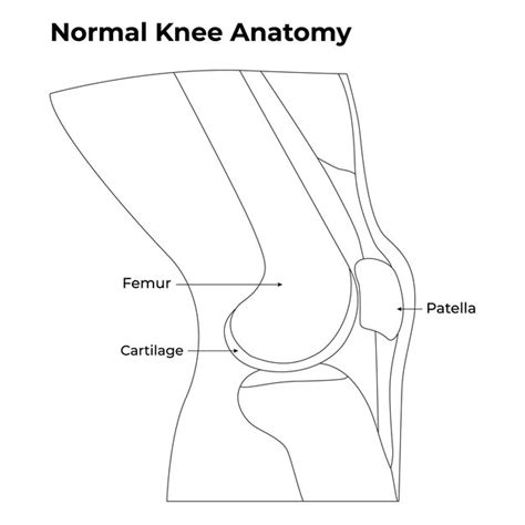 Premium Vector | A diagram of a knee and knee pain