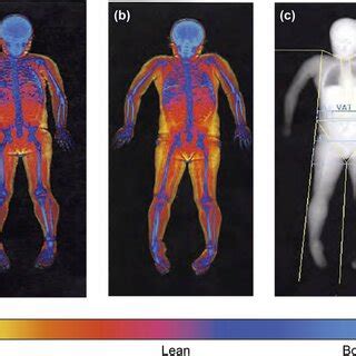 Representative DXA scan. A visual representation of fat mass, lean body... | Download Scientific ...