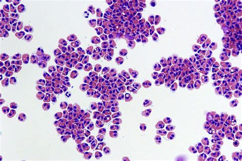 Differential White Cell Count Test | Healthengine Blog