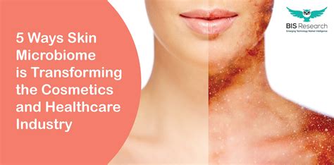 5 Ways Skin Microbiome is Transforming the Cosmetics and Healthcare Industry