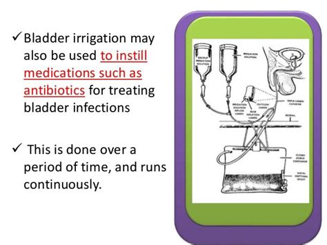 Cystoclysis bladder irrigation