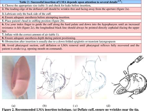 Laryngeal Mask Airway Sizes