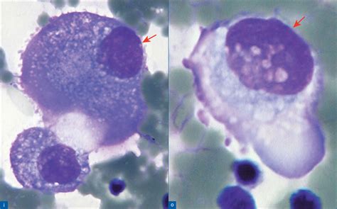 The panorama of different faces of mesothelial cells | Basicmedical Key