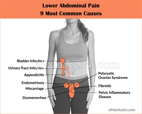 Lower Abdominal Pain: 9 Most Common Causes|Symptoms|Investigations|Treatment