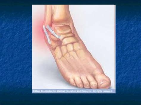 common diseases/disorders of the skeletal system