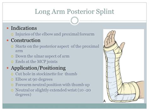 Long Arm Posterior Splint