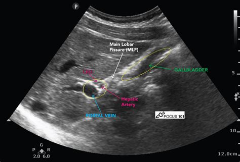 Abdominal Ultrasound Made Easy: Step-By-Step Guide - POCUS 101