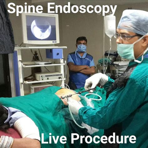 Endoscopic Discectomy - Impulse Pain