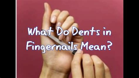 What Do Dents in Fingernails Mean? - YouTube