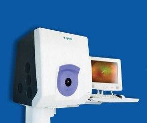 Optos® Retinal Exam | Eye Dr Camas | Dr. Scott Lewis, O.D.