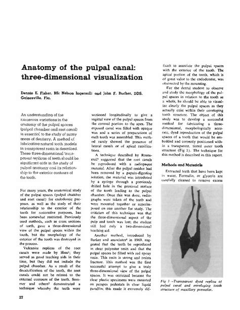 (PDF) Anatomy of the pulpal canal: three-dimensional visualization - DOKUMEN.TIPS