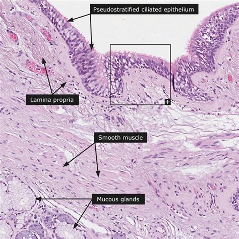 Normal: Bronchus - smooth muscle layer | RT baby! | Histology slides ...