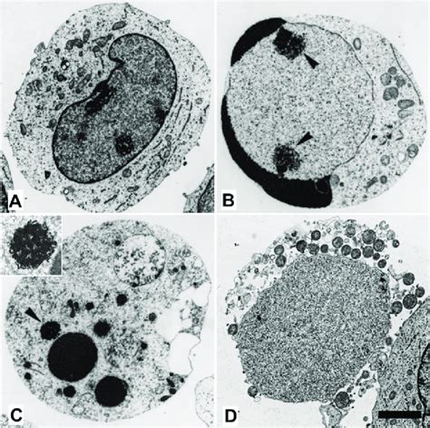 Transmission electron microscopic appearance of K562 cells (10). A:... | Download Scientific Diagram