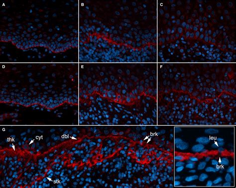 Composition of hemidesmosomes in basal keratinocytes of normal buccal ...