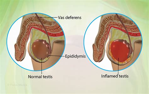 Health Condition : Symptoms, Causes, Treatment and More