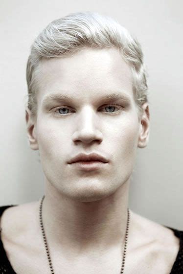 Who knows if he actually is albino? Regardless, pale and white is blank ...