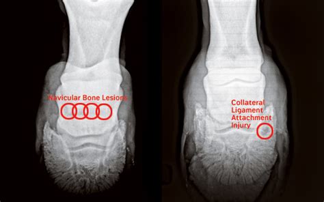 Navicular or Not?