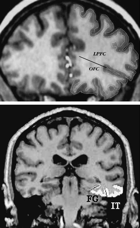 Structure of entorhinal cortex | Semantic Scholar