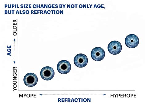 Pupil Sizing Chart | Portal.posgradount.edu.pe