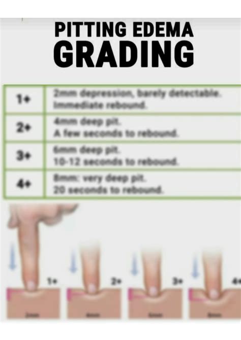 SOLUTION: Pitting edema grading - Studypool