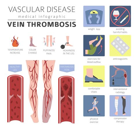 Deep Vein Thrombosis Prevention