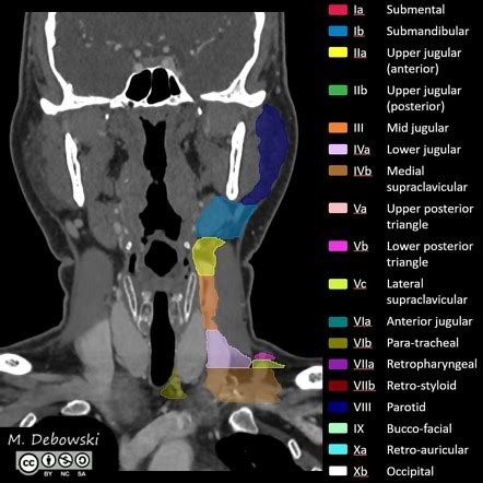 Lymph Node Map Face