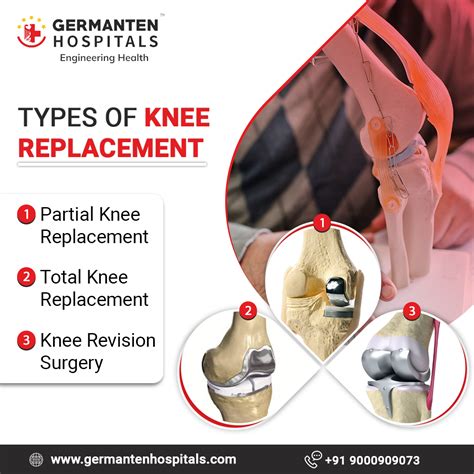 Pin on Best Knee Replacement Surgery in Hyderabad