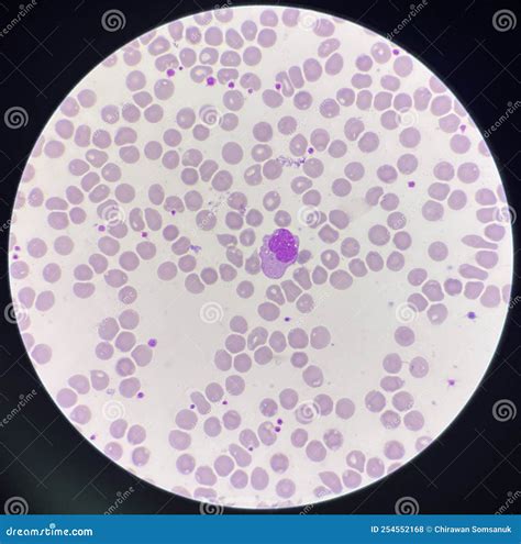 Monocyte White Blood Cells on Center Stock Photo - Image of body, immunology: 254552168