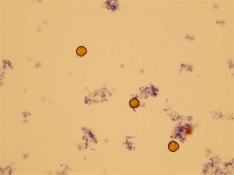 Microscopic Analysis of Urine | Faculty of Medicine, Masaryk University