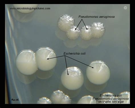 Tryptic soy agar in 2022 | Medical laboratory science, Medical laboratory scientist, Microbiology