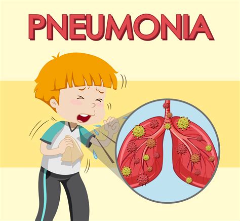 Poster design for pneumonia with boy coughing 1012955 Vector Art at ...