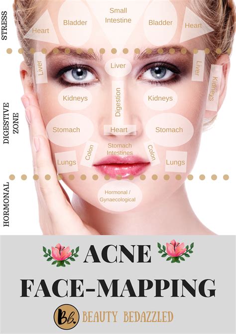 Acne Face Mapping - What does Your Acne Tell YOU? | Face mapping acne, Face acne, Face mapping