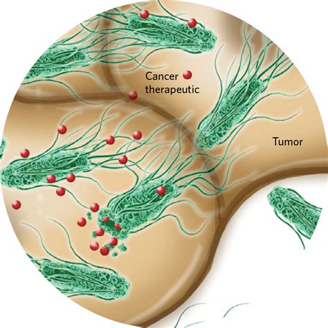 Infographic: Building Bacteria to Fight Cancer | The Scientist Magazine®