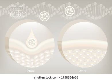 Hyaluronic Acid Before After Skin Solutions Stock Vector (Royalty Free) 1958854636 | Shutterstock