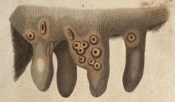 Cowpox - Alchetron, The Free Social Encyclopedia