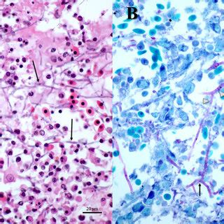 Morphologic observations of the Fusarium solani species complex (FSSC)... | Download Scientific ...