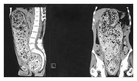 Gastrointestinal Blueprint Notes