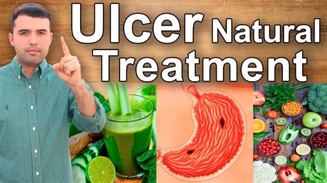 Best Juicing Recipes For Stomach Ulcers | Dandk Organizer