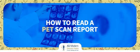 How To Read A PET Scan Report | AQMDI