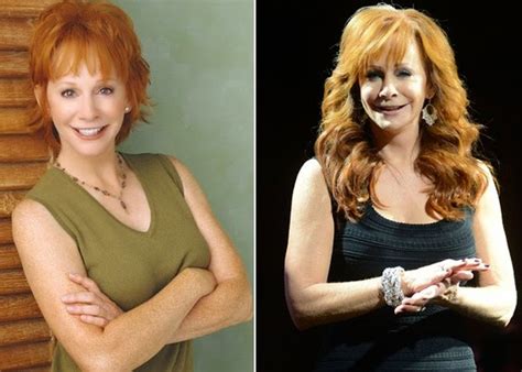 Reba McEntire Looks Great After Plastic Surgery