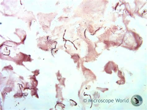 Microscope World Blog: Chromosomes under the Microscope