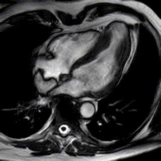 HEART FAILURE: THE LATEST IN DIAGNOSTIC TOOLS | TRANSTHORACIC ...