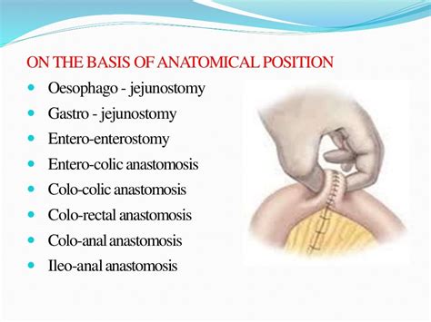 Bowel resection and anastomosis