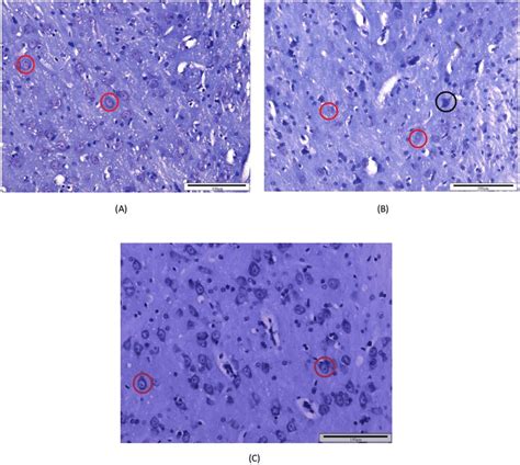 Histology of the left VPL of thalamus section of the offspring from (A ...