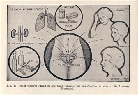 hysteria Archives - Society for Menstrual Cycle Research